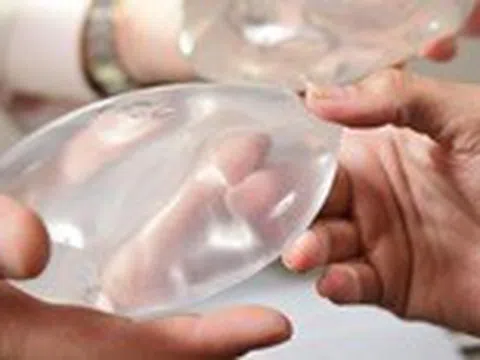 Đặt túi ngực ‘bảo hành trọn đời’, được 4 năm đã vỡ lúc nào không biết