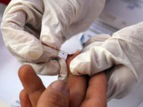 AI phát hiện 3 bệnh ung thư nguy hiểm chỉ với một giọt máu khô