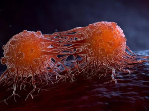 Giấc mơ về vaccine ung thư đang đến gần