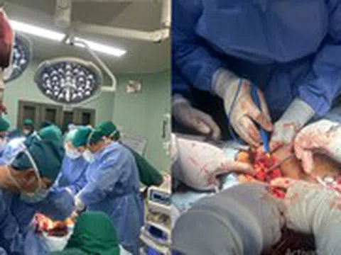 Bệnh viện Nhi đồng TP cứu sống một người lớn bị dao đâm vào ngực