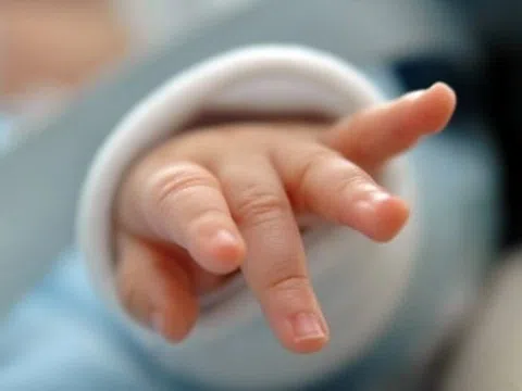 Em bé Hà Nội chào đời với hội chứng siêu nữ ít gặp