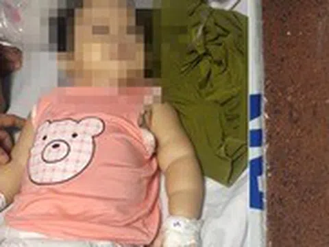 Bé gái 11 tháng tuổi ngộ độc chì nặng sau khi dùng thuốc gia truyền