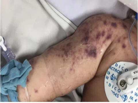 Căn bệnh tấn công vào não khiến thanh niên rét run, co giật