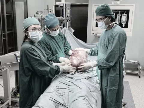 Khối u khổng lồ trong cơ thể bé gái 12 tuổi