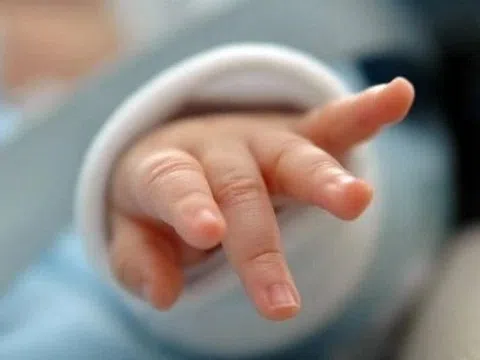 Những người mang hội chứng siêu nữ