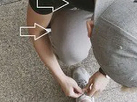 Bác sĩ cảnh báo tư thế ngồi xổm cúi gập người có thể gây đột quỵ