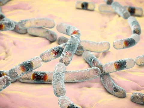 Có gì trong món canh chua giá khiến nhiều người ở Vĩnh Phúc vào viện