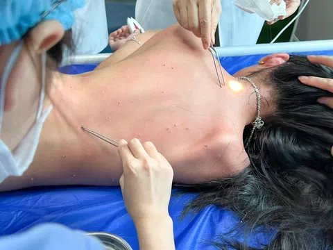 Hai mẹ con ở Hải Phòng bị ong đốt 100 mũi vì khách sạn phá tổ ong