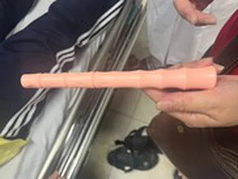 Kẹt đồ chơi tình dục dài 30cm trong hậu môn, nam sinh suýt thủng ruột