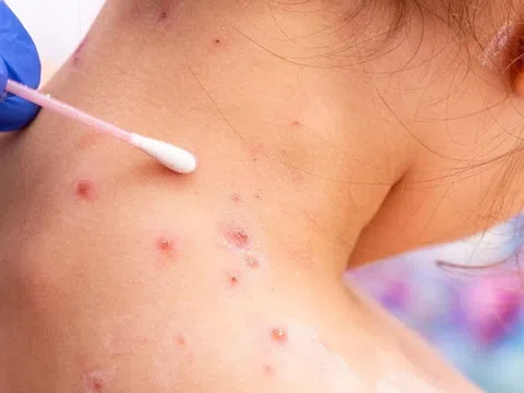Bé trai nguy kịch vì căn bệnh quen thuộc