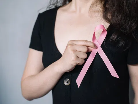 Những người nên tầm soát ung thư vú