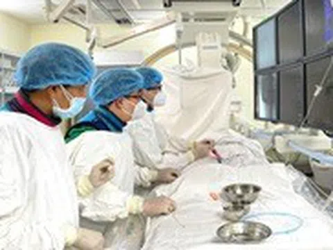Người đàn ông đột quỵ vì giác hơi không an toàn tại nhà