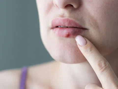 Dấu hiệu trên mặt cảnh báo bất thường, cần đi khám ngay