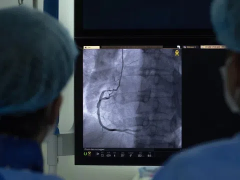 Thủ phạm số 1 khiến người trẻ nhồi máu cơ tim