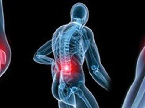 Cẩn thận biến chứng khi chữa xương khớp bằng các phương pháp lạ