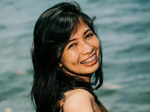 Chiêu 'săn' khách niềng răng của các cơ sở nha khoa