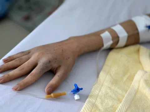 Những thay đổi trên cơ thể có thể là dấu hiệu của ung thư
