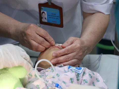 Ca xạ trị đặc biệt cho bé gái mắc ung thư vùng kín