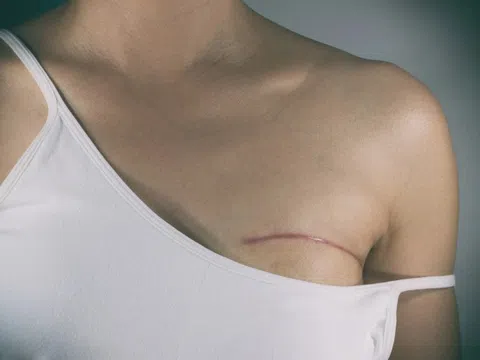 Mắc ung thư ở tuổi 29