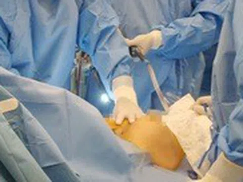 Người phụ nữ vào Kangnam Sài Gòn hút mỡ bụng bị nguy kịch phải chuyển Chợ Rẫy