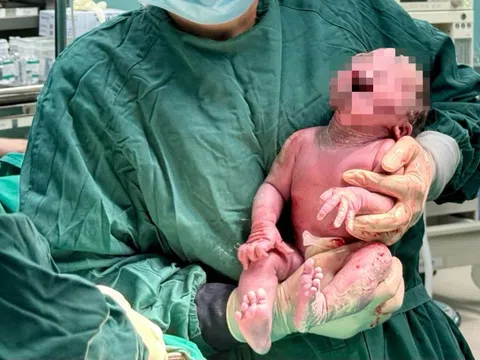 Người mẹ cao 1,3 mét sinh bé gái nặng 3,5 kg