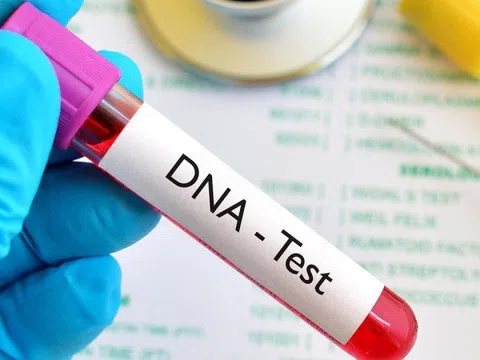 Vợ tố cáo âm mưu lợi dụng xét nghiệm ADN của chồng