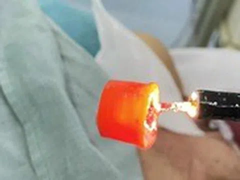 Lấy nắp chai dầu trong cổ cụ ông 74 tuổi