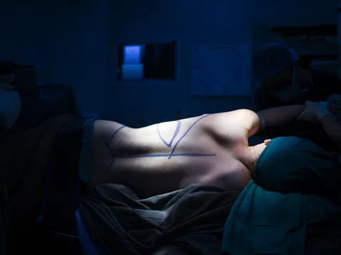 Căn bệnh ung thư đứng đầu tại Việt Nam