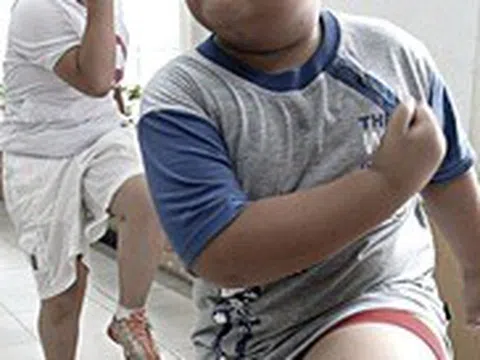 Vì sao người thừa cân béo phì nhưng lại suy dinh dưỡng?
