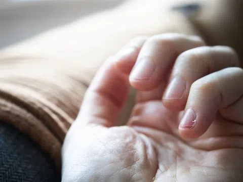 Nguyên nhân gây xước măng rô