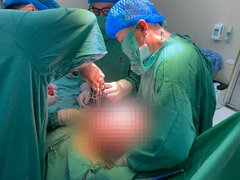 Căn bệnh khiến bụng người phụ nữ căng tức, liên tục phình to