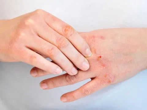 Dấu hiệu thận đang dần mất chức năng, nên đi khám sớm