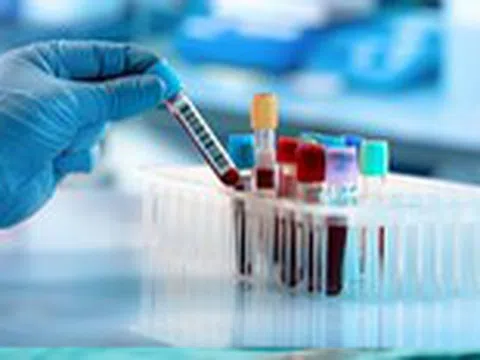 7 xét nghiệm máu không cần nhịn ăn