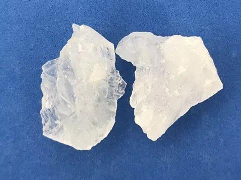 Nhiễm độc nhôm vì dùng phèn chua chữa hôi nách