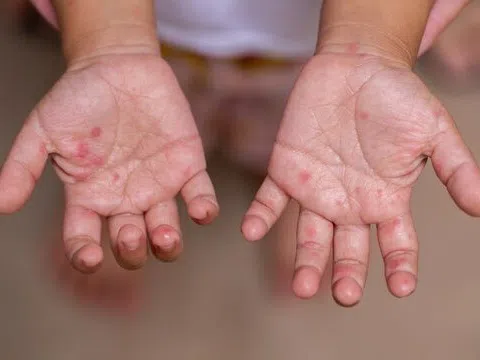 Đồng Nai tăng cường phòng chống dịch chủ động