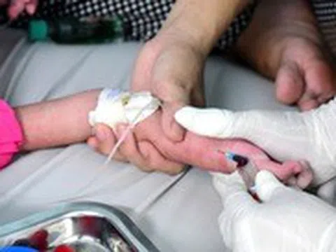 Ngăn dịch sởi, những ai cần tiêm ngừa?