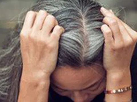 Căng thẳng có khiến tóc bạc đi?