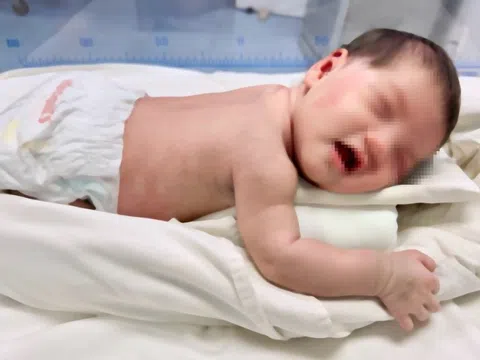 Bé sơ sinh bị bỏ rơi, giòi bu khắp người
