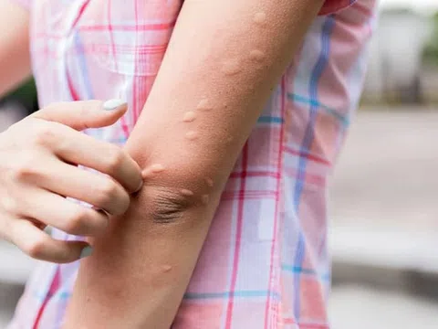 Đã ghi nhận gần 53.000 ca mắc sốt xuất huyết