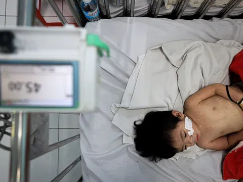 3 nhóm trẻ có nguy cơ rất cao với bệnh sởi, cần được bảo vệ