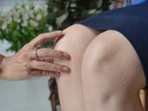 Thoái hóa khớp gối: Ăn xương có bổ xương?