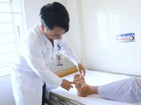 Tứ chi biến dạng gây ám ảnh của người đàn ông mắc bệnh Gout
