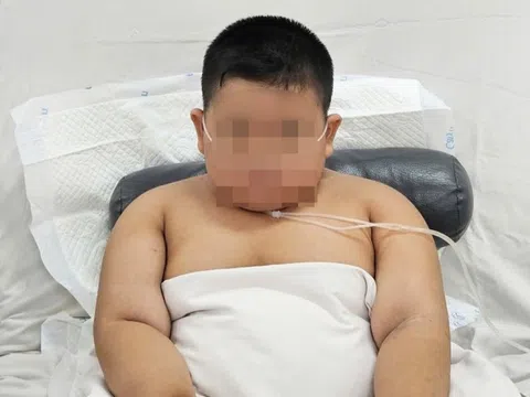 Bé trai tăng 35 kg trong 6 tháng, nguy kịch sau 3 ngày nhiễm cúm