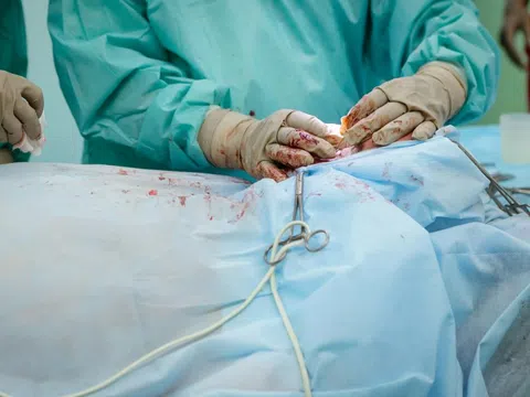Thanh niên ở Phú Thọ tử vong khi cắt bao quy đầu