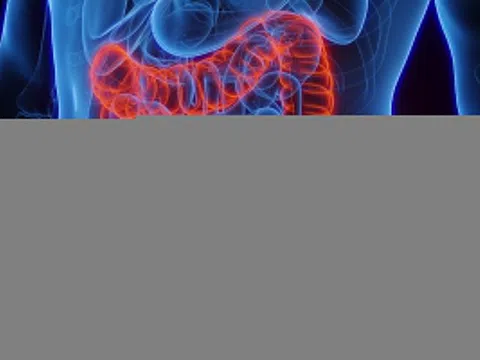 Dấu hiệu sớm của ung thư ruột non