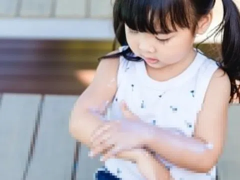 Những sai lầm khiến trẻ dễ mắc bệnh về da