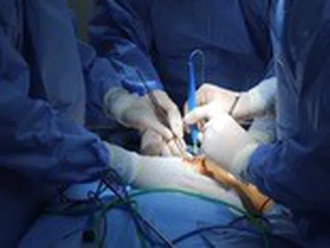 Thông tin về loại ung thư tuyến mồ hôi hiếm gặp, biểu hiện rất dễ nhầm lẫn với bệnh khác