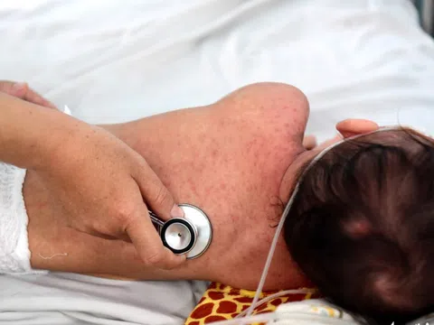 Cần Thơ tổ chức hai đợt tiêm ngừa bệnh sởi toàn thành phố