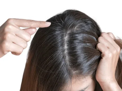 Nhổ tóc, nhuộm tóc làm tóc bạc sớm?