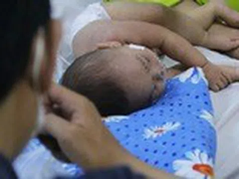 Số ca mắc sốt xuất huyết, tay chân miệng và sởi tại TP.HCM tăng